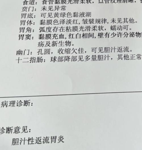 胃部感觉堵塞感是怎么回事